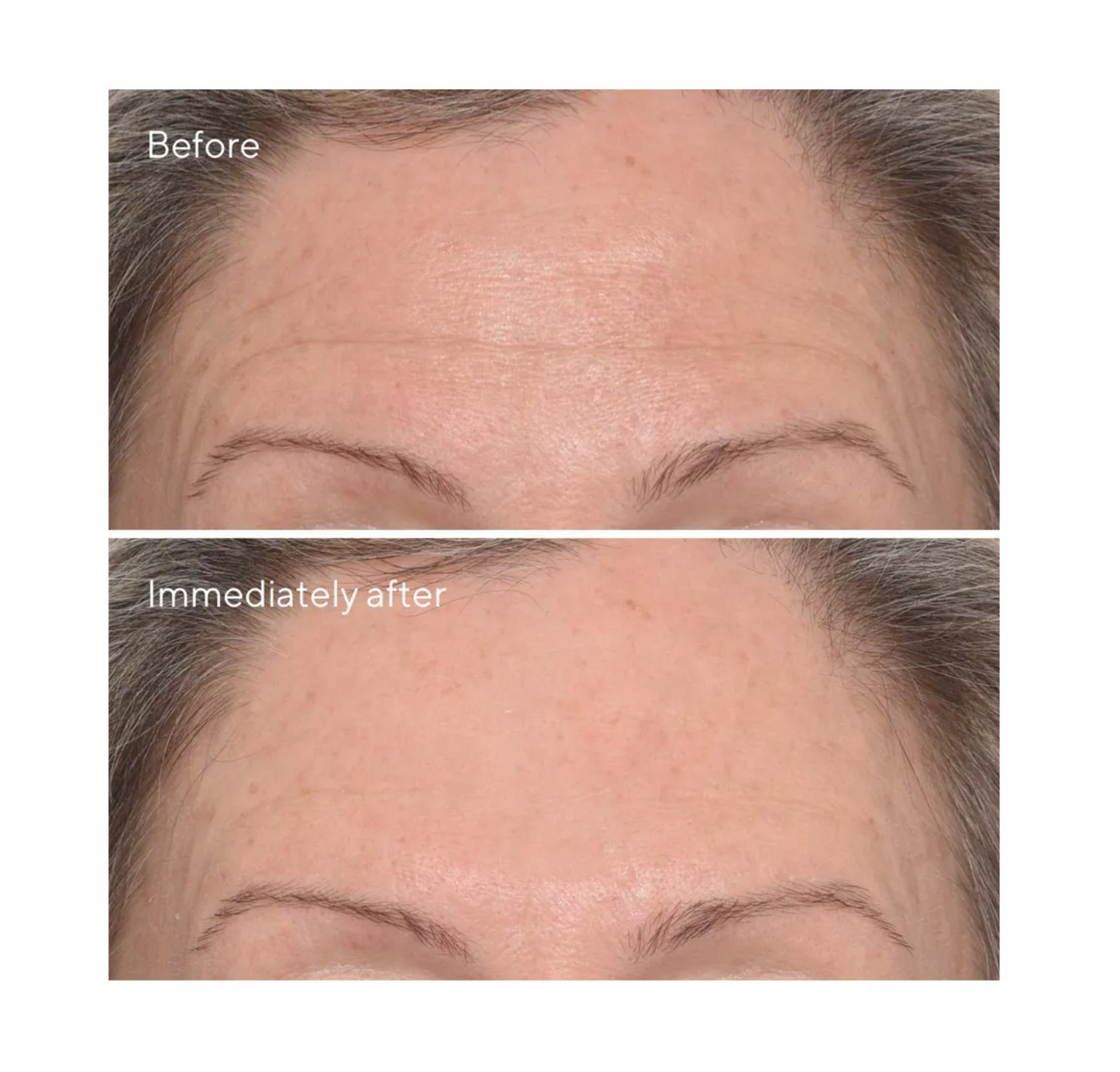 MURAD Targeted Wrinkle Corrector 15ml