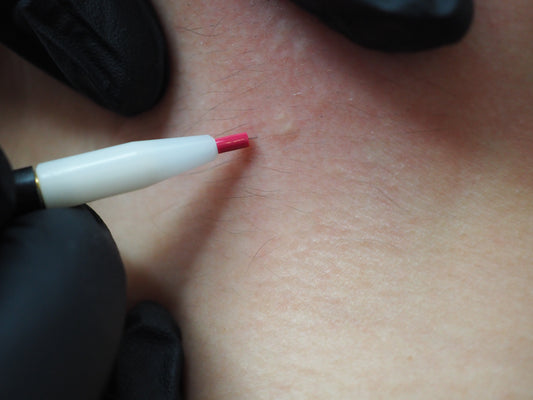 Electrolysis