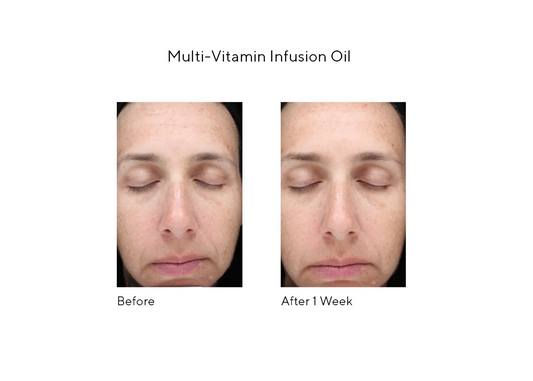 MURAD Multi Vitamin Infusion Oil 30ml